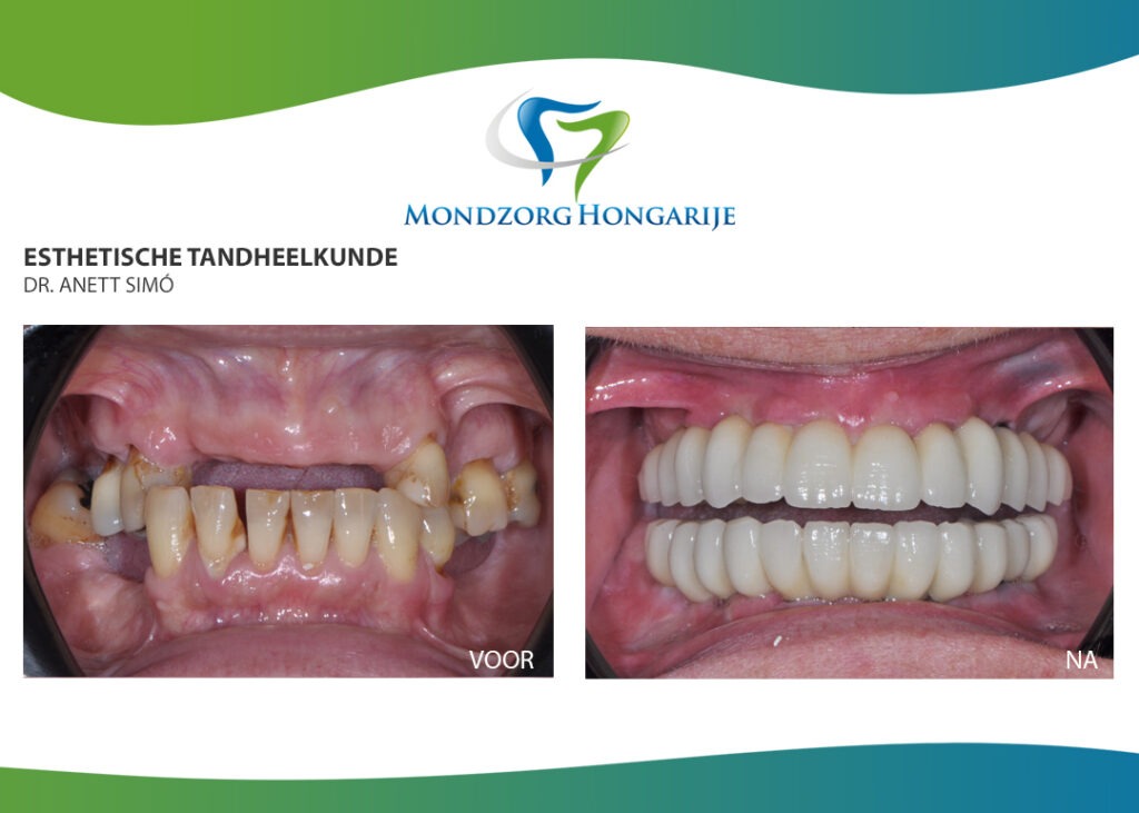 Vaste oplossing tandarts
